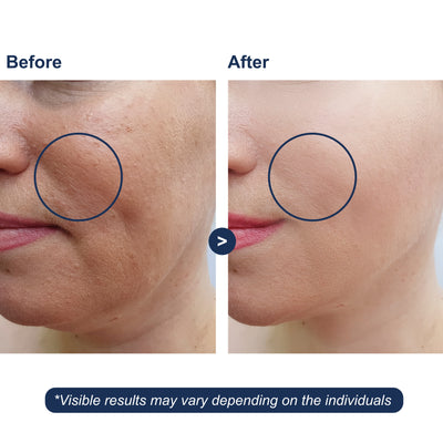 Micro Ingredients HA Serum with Vitamin B5, C, E, Witch Hazel, & Centella – 4 FL OZ